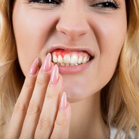How Gum Disease Increases Your Risk of COVID-19 Complications